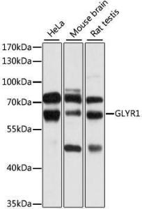 Anti-GLYR1 Antibody (A10604)