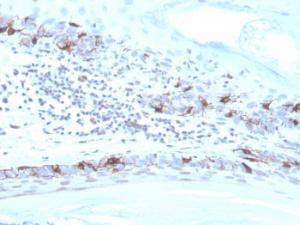 Immunohistochemical analysis of formalin-fixed, paraffin-embedded human skin using Anti-MelanA Antibody [MLANA/4475R]