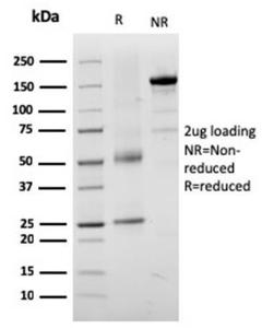 SDS-PAGE analysis of Anti-TRP1 Antibody [TYRP1/3282] under non-reduced and reduced conditions; showing intact IgG and intact heavy and light chains, respectively. SDS-PAGE analysis confirms the integrity and purity of the antibody