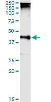 Anti-TARBP2 Rabbit Polyclonal Antibody