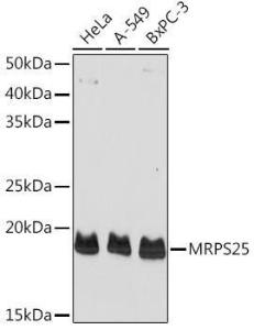 Western blot analysis of extracts of various cell lines, using Anti-MRPS25 Antibody (A10612) at 1:1,000 dilution. The secondary antibody was Goat Anti-Rabbit IgG H&L Antibody (HRP) at 1:10,000 dilution.