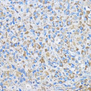 Immunohistochemistry analysis of paraffin-embedded rat ovary using Anti-FAM3D Antibody (A308559) at a dilution of 1:50 (40x lens) Perform microwave antigen retrieval with 10 mM PBS buffer pH 72 before commencing with IHC staining protocol