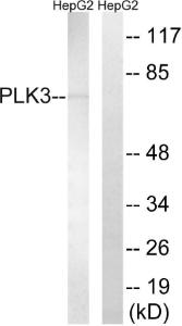 Anti-PLK3 antibody