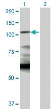 Anti-HK1 Rabbit Polyclonal Antibody