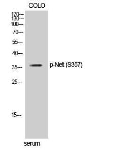 Anti-ELK3 Rabbit Polyclonal Antibody