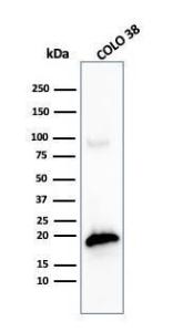 Western blot analysis of COLO-38 cell lysate using Anti-MelanA Antibody [MLANA/4475R]