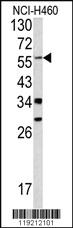 Anti-YAP1 Rabbit Polyclonal Antibody