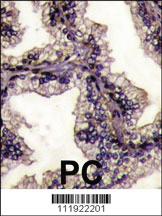 Anti-Lactoferrin (LTF) Rabbit Polyclonal Antibody