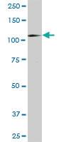 Anti-HK1 Rabbit Polyclonal Antibody