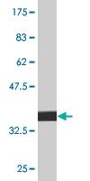 Anti-PPOX Mouse Monoclonal Antibody [clone: 2B5]