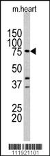 Anti-Lactoferrin (LTF) Rabbit Polyclonal Antibody