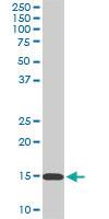 Anti-RPL36A Mouse Monoclonal Antibody [clone: 6H1]