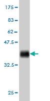 Anti-ACACA Mouse Monoclonal Antibody [clone: 6H5]