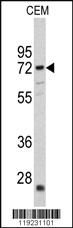 Anti-CRAT Rabbit Polyclonal Antibody