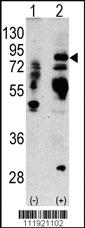 Anti-Lactoferrin (LTF) Rabbit Polyclonal Antibody