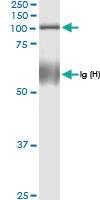 Anti-TUBGCP2 Rabbit Polyclonal Antibody