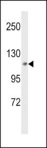 Anti-MAP4K3 Rabbit Polyclonal Antibody (AP (Alkaline Phosphatase))