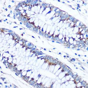 Immunohistochemistry analysis of paraffin-embedded human colon tissue using Anti-FAM3D Antibody (A308559) at a dilution of 1:50 (40x lens) Perform microwave antigen retrieval with 10 mM PBS buffer pH 72 before commencing with IHC staining protocol