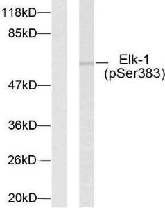 Western blot analysis of lysates from HeLa cells treated with UV using Anti-Elk1 (phospho Ser383) Antibody The left hand lane represents a negative control, where the antibody is blocked by the immunising peptide