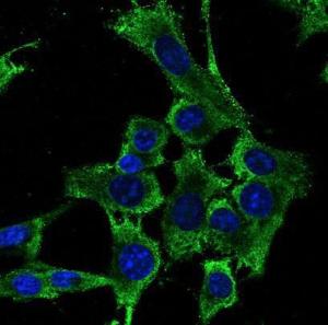 Antibody anti-RPS6 800 µg