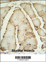 Anti-CRAT Rabbit Polyclonal Antibody