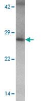 Anti-TMEM106B Rabbit Polyclonal Antibody