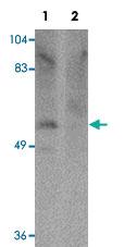 Anti-PPAPDC1A Rabbit Polyclonal Antibody