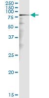 Anti-CALD1 Polyclonal Antibody Pair