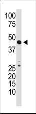 Anti-GDF3 Rabbit Polyclonal Antibody (AP (Alkaline Phosphatase))