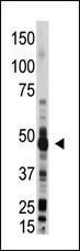 Anti-OAS1 Rabbit Polyclonal Antibody (Biotin)