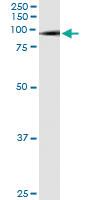 Anti-SMURF1 Antibody Pair