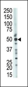 Anti-TSG101 Rabbit Polyclonal Antibody (Biotin)