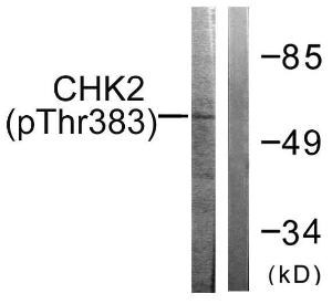 Antibody anti-CHK2 phospho THR383 100 µg