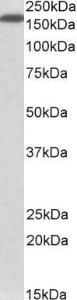 Anti-NFASC Antibody (A82546) (0.5µg/ml) staining of Human Lung lysate (35µg protein in RIPA buffer). Primary incubation was 1 hour. Detected by chemiluminescence.