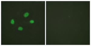 Antibody anti-CHK2 phospho THR383 100 µg