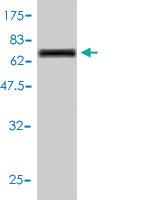 Anti-CTSD Mouse Monoclonal Antibody [clone: 3F12-1B9]