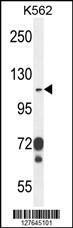 Anti-ITGAE Rabbit Polyclonal Antibody (AP (Alkaline Phosphatase))