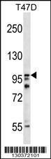 Anti-HPS3 Rabbit Polyclonal Antibody (HRP (Horseradish Peroxidase))