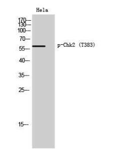 Antibody anti-CHK2 phospho THR383 100 µg