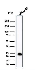 Anti-MelanA antibody