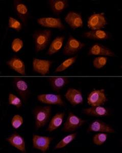 Antibody anti-CRYGC 100 µl