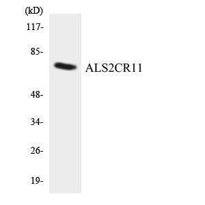 Western blot analysis of the lysates from COLO205 cells using Anti-ALS2CR11 Antibody