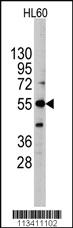 Anti-ALPI Rabbit Polyclonal Antibody