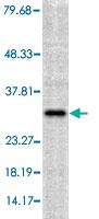 Anti-HMOX1 Rabbit Polyclonal Antibody