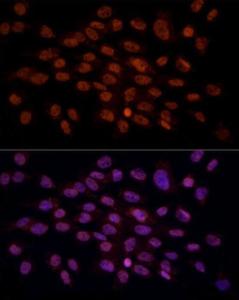 Antibody anti-CRYGC 100 µl