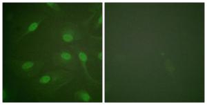 Immunofluorescence analysis of HeLa cells using Anti-Chk1 (phospho Ser301) Antibody The right hand panel represents a negative control, where the antibody was pre-incubated with the immunising peptide