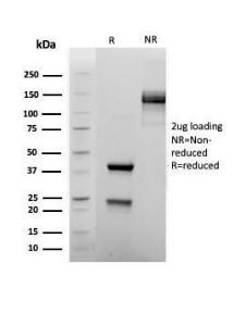 SDS-PAGE analysis of Anti-FOXP1 Antibody [rFOXP1/6902] under non-reduced and reduced conditions; showing intact IgG and intact heavy and light chains, respectively. SDS-PAGE analysis confirms the integrity and purity of the antibody