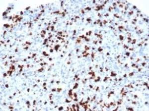 Immunohistochemical analysis of formalin-fixed, paraffin-embedded human lymph node tissue using Anti-TIA1 Antibody [TIA1/1352R]