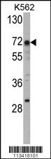 Anti-ARID3B Rabbit Polyclonal Antibody