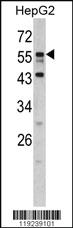 Anti-DONSON Rabbit Polyclonal Antibody